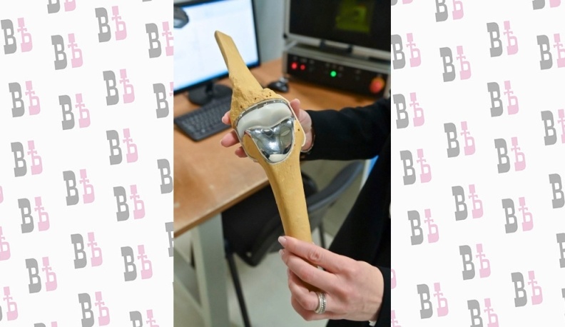 На обнинском производстве запустили выпуск компонентов коленного сустава