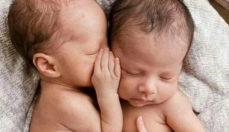 В Калуге за неделю родилась одна двойня