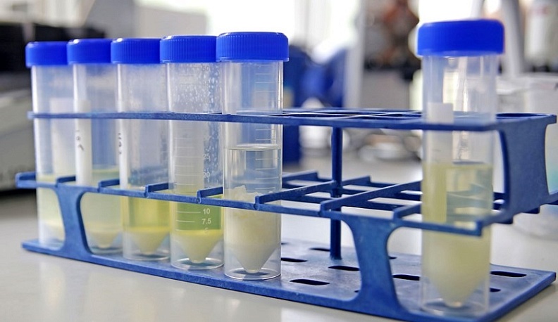 В Калужской области возбудили уголовное дело по факту фальсифицирования творога