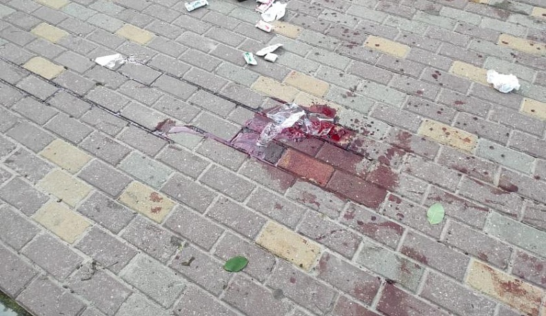 В Калуге 36-летний мужчина ударил ножом в шею бывшую жену и ее знакомого