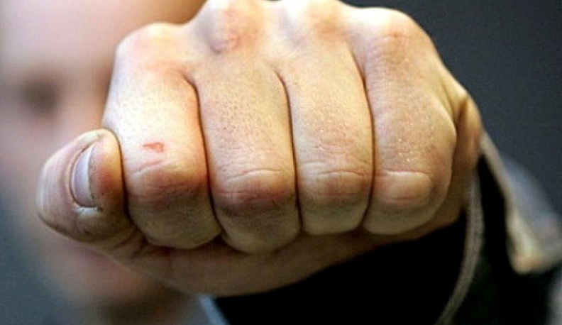 Калужанин ослеп на один глаз после драки на дороге