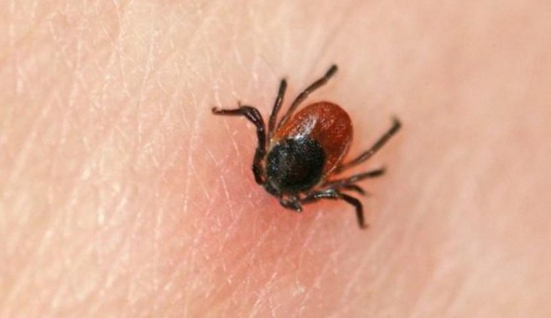 В Калужской области откроется "горячая линия" по профилактике клещевого энцефалита