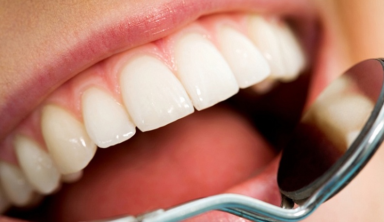 20 марта стоматологические клиники осмотрят всех бесплатно