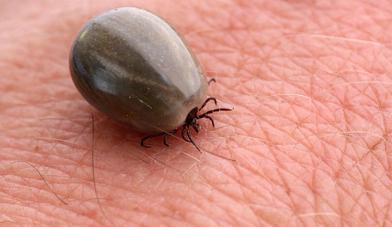 Что делать, если укусил клещ? 