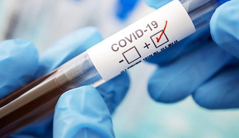 В калужском минздраве рассказали, когда эффективен ПЦР-тест