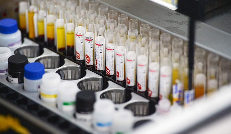 В Калужской области стартовала неделя профилактики заболеваний печени