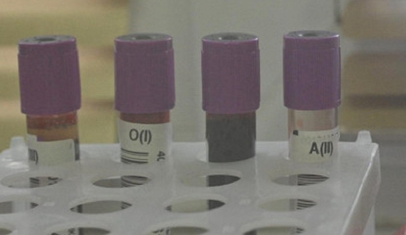 В Калуге в марте пройдёт очередная неделя бесплатного экспресс-тестирования на ВИЧ и Гепатит С