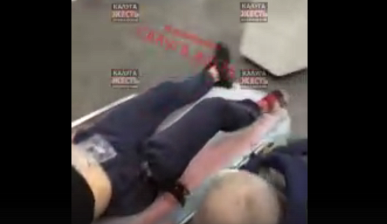 В центре Калуги юноша получил ножевое ранение 