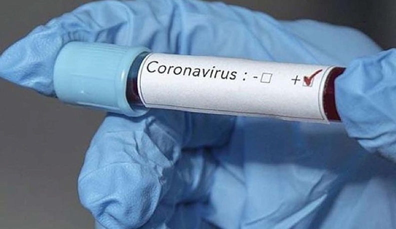 В Калужской области за сутки выявили 57 новых случаев заражения ковидом