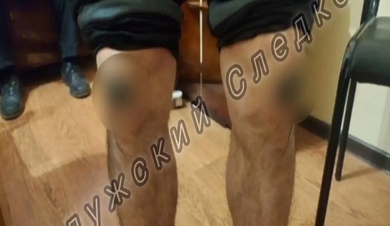 В Медыни осужденный ответит в суде за экстремистские татуировки