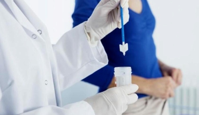 За год 11 тысяч калужанок прошли тестирование на ВПЧ