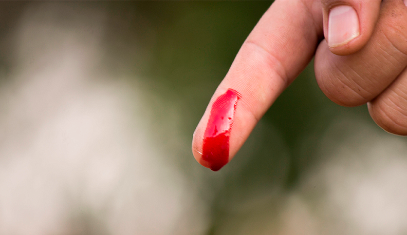 Москвич порезал себя после ссоры с сожительницей в Балабанове