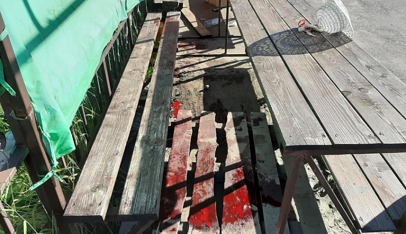 В Калужской области двое пенсионеров подверглись нападению и получили ножевые ранения